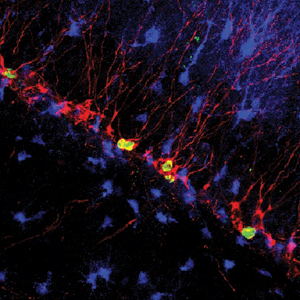 Newly-born nerve cells in the hippocampus. UC Berkeley image.